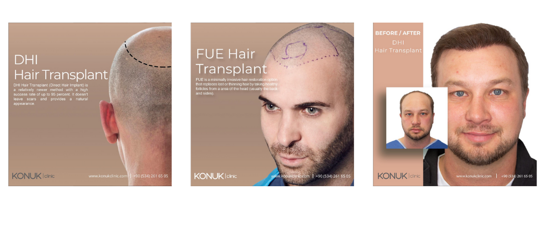 Hair transplant | Breast augmentation | Rhinoplasty| Abdominoplasty| Konuk Clinic