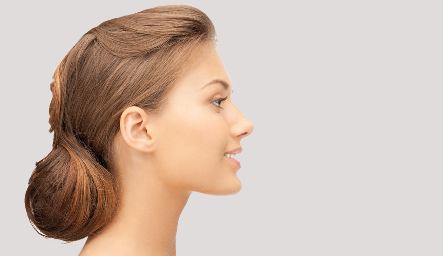 Rhinoplasty